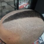 hair1