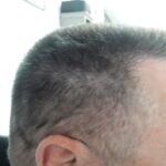 hair17